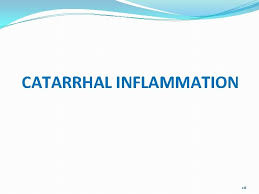 Catarrhal inflammation of the eustachian tube. Inflammation Dr Rabia Rathore Assistant Professor West Medical