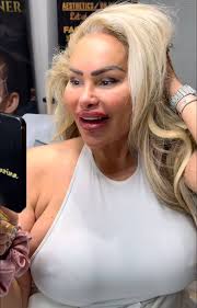 Chantel: let's Lift your face with Botox… She look like Darcey‼️Agree⁉️ 90  Day Fiance #90dayfiance