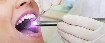 Image result for dental cancer