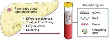 If you have one that doesn't. Blood Biomarkers For Differential Diagnosis And Early Detection Of Pancreatic Cancer Cancer Treatment Reviews