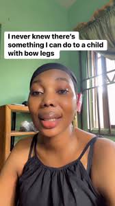 Just like me, many mothers believe bow legs are normal in children and  they'll outgrow it. Hmmm! Indeed everything has solutions