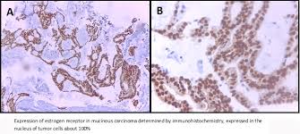 The particular slang may originate from northern mexico, particularly in the western coastal states of sonora. Mucinous Carcinoma Of The Breast A Case Report And Review Of The Literature Medwave