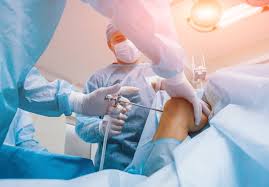 Surgeons suggest the reasons people come in for meniscus surgery is over expectation of what how it does this, is that the radial tie fibers, the perpendicular mesh network of the meniscus are. Arthroscopic Knee Surgery Cost Causes More Torrance Ca