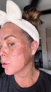 Attiva Skin Treatment in Vegas