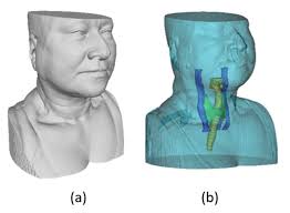 3D Multi-Modality Medical Imaging: Combining Anatomical and Infrared  Thermal Images for 3D Reconstruction