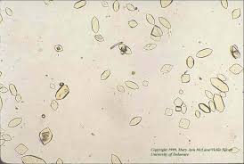 Membrane stabilizing drags, decreasing the oxalatic excretion with urine are applied in the medical treatment. Pin On Urine