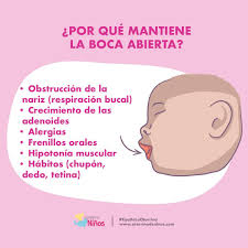 Tener la boca abierta depende de muchos factores. Aunque la obstrucción  respiratoria es frecuente, hay otros aspectos a evaluar y considerar. Lo  ideal es hacerlo en equipo entre profesionales de distintas disciplinas,