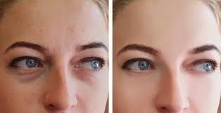 Of course, men also sometimes get a puffy face, which means that it cannot always be attributed to the female hormones. Waking Up With A Puffy Face Try These Tips To De Puff Lifestyle News The Indian Express