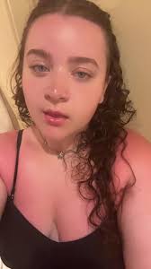 🌺🤍 #vacation #sunburn