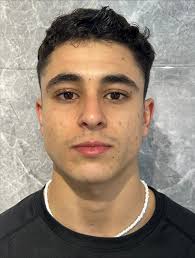 MIRA ESTE CAMBIO. Tratamiento de acné con el Dr. Ignacio Moreno” Mirá este  antes y después… Un cambio impresionante en la piel, con resultados reales.  En Nuolaser Clínica Estética, tratamos el acné