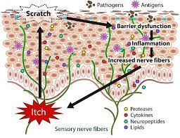 Allergic contact dermatitis from kiwi fruit vine (actinidia. Biomedicines Free Full Text Intractable Itch In Atopic Dermatitis Causes And Treatments Html