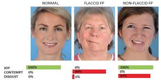 Traditional or Robotic Surgery?