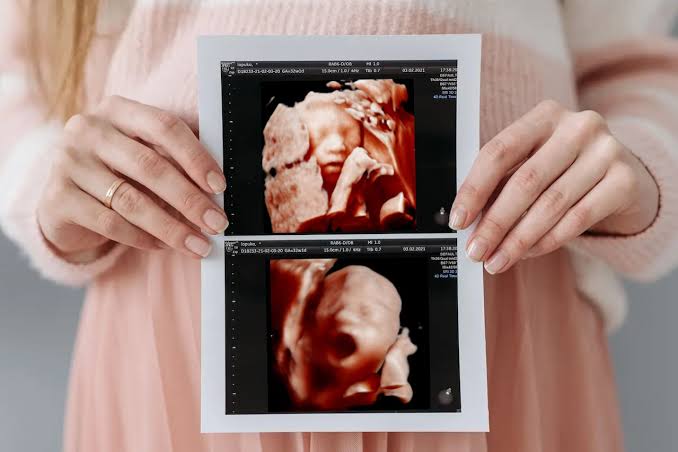 4D Scan | Amazing Colour Life-like Baby Scan! | Scan Clinic