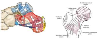 Image result for Calcaneus Compression Fracture