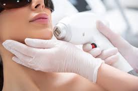 Laser procedure step at Profrea