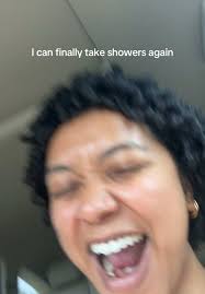 Washing Broken Leg First Time Soap Surgery