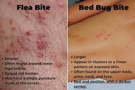 Image result for bedbugs bites