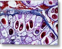 Image result for Beef Tapeworm