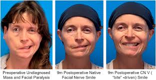 The Laryngoscope: Early View