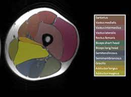 Along the upper portion of the thigh, just lateral to the gracilis, the adductor longus muscle is ranked as the most anterior of this group of thigh muscles. Xm7fxi4 Nsmi M