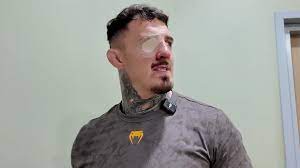 Tom Aspinall Provides Update On Injured Eye Following Ciryl Gane Fight