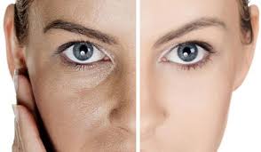 Gozeneklerin Genislemesine Ne Neden Olur Genislemis Gozenekler Rahatsiz Edici Olurlar Bir Cok Bayan Makyajla Gozenekleri Kapatmak 2020 Cilt Bakimi Yuzler Estetik