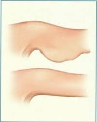 Saglikli Zayiflamak Istiyorum Herbalife Herbalife Saglikli Spor Aktiviteleri Saglik