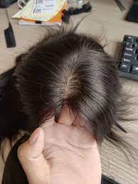 Very Natural Looking Custom Made Remy Human Hair Medical Wigs For Alopecia Women Hairstyles For Thin Hair Hairpieces For Women Hair Toppers
