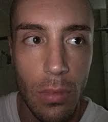 Observed Impulse: Myofascial Release for the Face: Composure, Aesthetics  and Mental Health