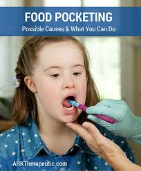 Great news!!!you're in the right place for pocketing food. Food Pocketing In The Lips Cheeks And Or Gums Ark Therapeutic