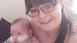 Birmingham dad and daughter have same surgery 35 years apart