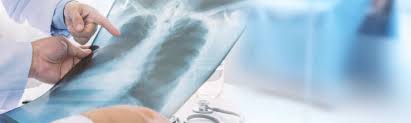 We did not find results for: Stuart Mesothelioma Lawyer Asbestos Gordon Partners