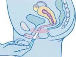 Vediamo qual è la loro utilità. Assorbenti Interni Prezzi Consigli Vantaggi E Controindicazioni