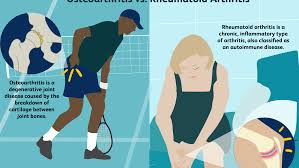 Osteoarthritis Vs Rheumatoid Arthritis