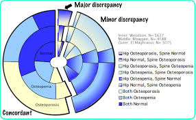 Discordance Between Spine And Hip