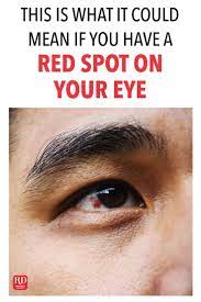 Pin On Eyes