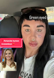 What Caused Amanda Bynes Breakdown