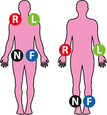 12 Lead Ecg Placement Aed Superstore Resource Center