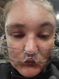 Asking for prayers; I have extremely painful cellulitis, I'm overseas in a  3rd World country. I'm praying the antibiotics work. I can't go home for  another day. It's frightening