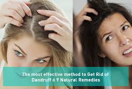The Most Effective Method To Get Rid Of Dandruff 9 Natural Remedies