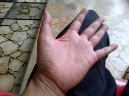 Maksud gatal tapak tangan sebelah kanan. Ki Joko Bodo On Twitter Bila Telapak Tangan Kiri Gatal Per Tanda Akan Dapat Rejeki Bila Tela Pak Tangan Kanan Gatal Dijanjikan Uang Oleh Orang Http T Co Ofyo885l