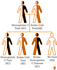 Scd can lead to lifelong disabilities and reduce average life expectancy. Sickle Cell Disease Information For Parents Healthychildren Org