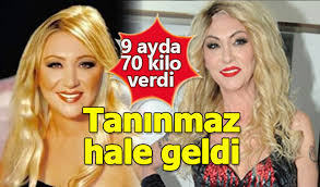 Güllü kimdir, hayatı ve biyografisi. 9 Ayda 70 Kilo Veren Gullu Taninmaz Hale Geldi