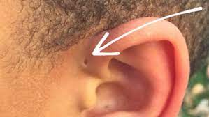 Codycross trous naturels comme les narines ou les oreilles solution est disponible ici. Pourquoi Certaines Personnes Ont Un Trou Au Dessus De L Oreille