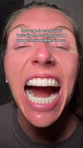 Affordable Dentist-Led Clear Aligners in the UK