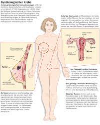 Brustkrebs Erbsengrosser Tumor Gesundheitsberater Berlin
