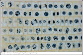Onion Root Tip Mitosis Lab Report Image Search Results
