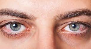 This is the most common type. Glaucoma All You Need To Know About This Eye Disease