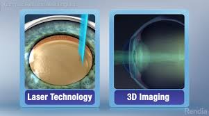 Image result for Cataract Extraction