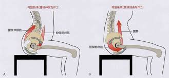 「骨盤前傾　図」の画像検索結果